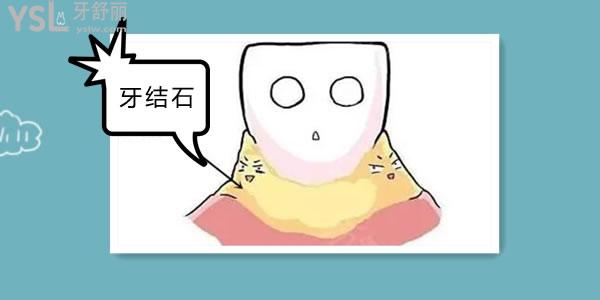 淘宝上的牙结石去除器有用吗