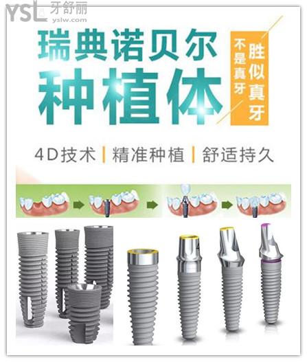 2021年瑞典诺贝尔种植牙全系列价格表 与瑞士ITI.jpg