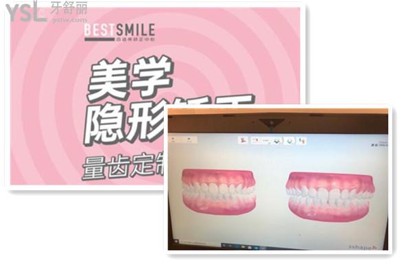 美学定制