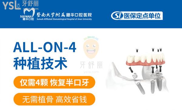 广州穗华口腔ALL-ON-4种植技术