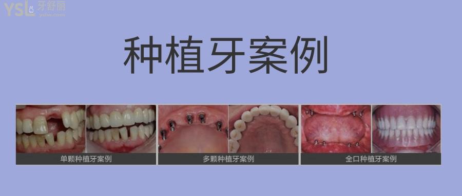 扬州比较好的牙科医院排名