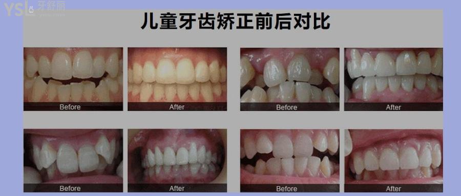 扬州比较好的牙科医院排名