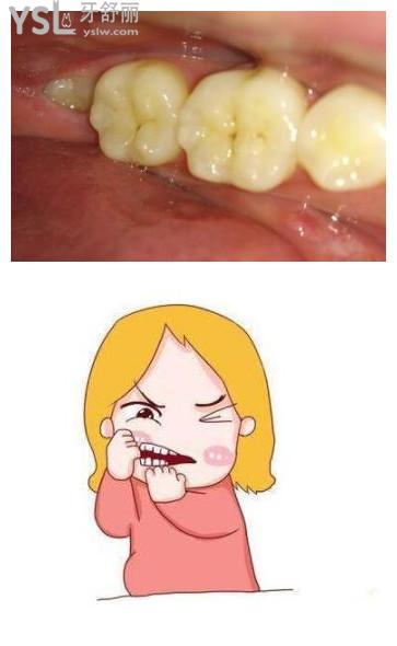 牙洞