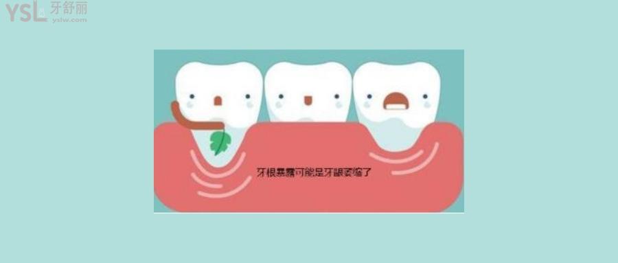 老年人牙齿脱落是什么原因引起的
