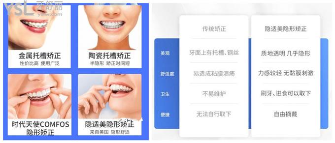 牙齿矫正优势