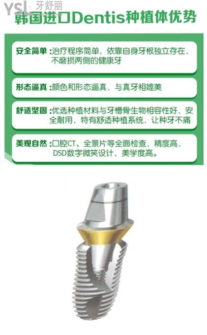 韩国登特斯dentis种植体