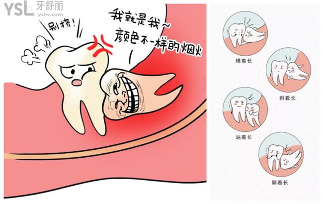 智齿图