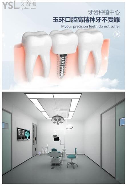 台州玉环口腔种植牙技术