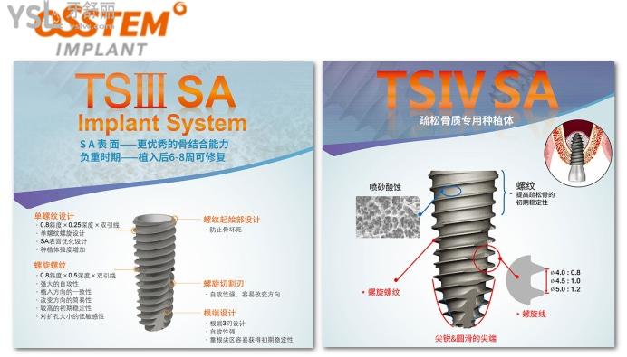 韩国OSSTEM奥齿泰种植体