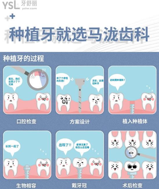 郑州马泷齿科种植过程图