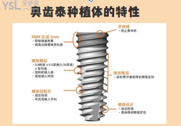 韩国奥齿泰种植牙的使用寿命跟这几点息息相关 大家一定要了解.jpg