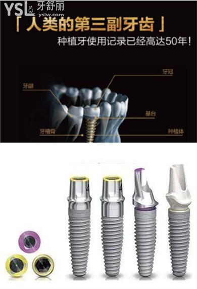 成都锦江区镶牙多少钱