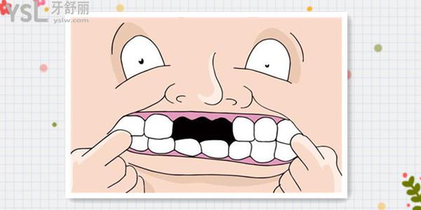 38岁牙齿脱落的原因 千万别忽略牙周炎这个原因.jpg
