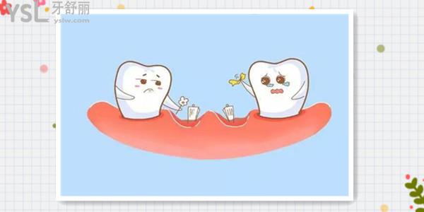 38岁牙齿脱落的原因 千万别忽略牙周炎这个原因.jpg