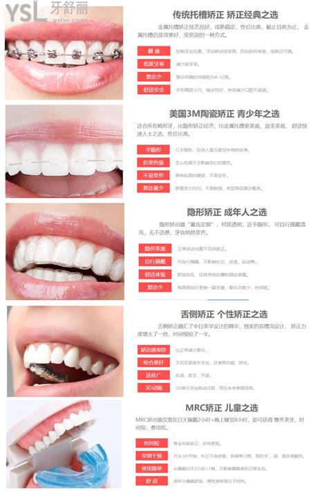 广州牙齿矫正多少钱 广州牙套价格