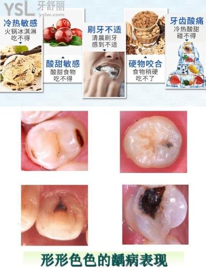 牙体牙髓病的症状表现有哪些