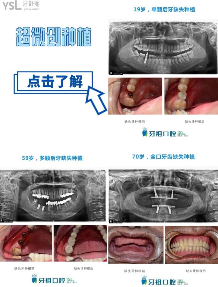 长沙口腔医院哪家好
