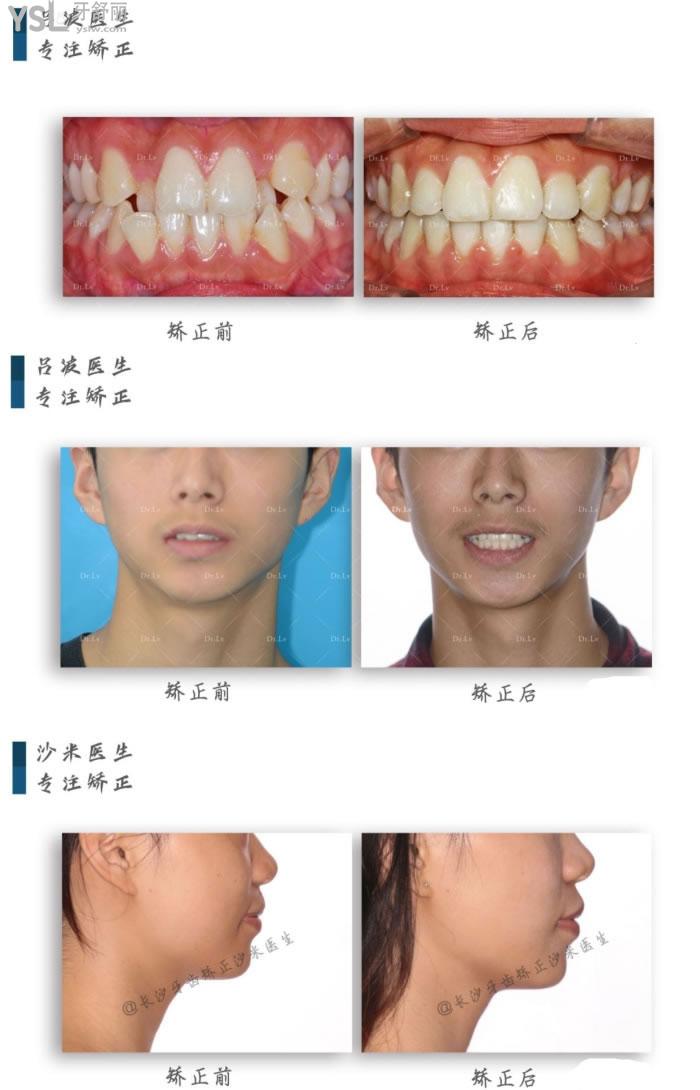 长沙口腔医院哪家可以