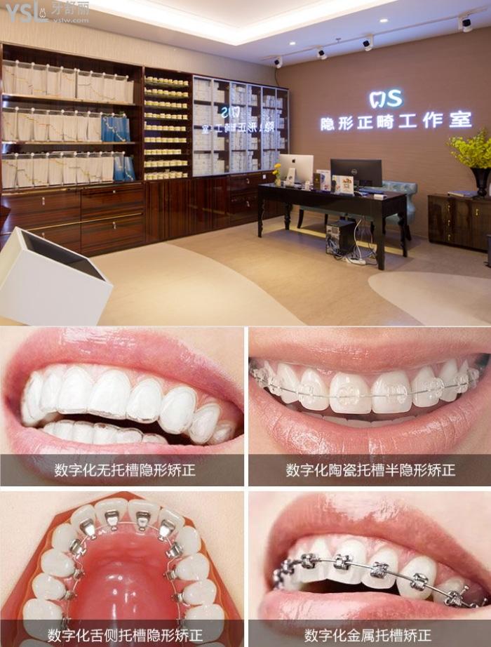 北京劲松口腔医院有半隐形矫正吗？做的怎么样大概多少钱？