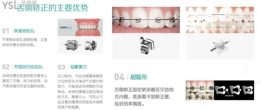 西安画美团圆口腔医院价目表