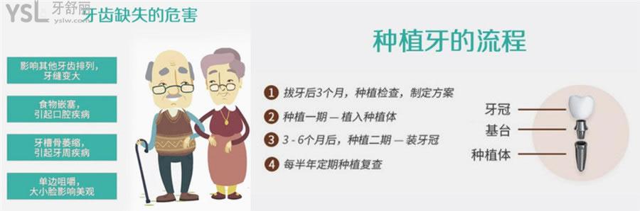 西安画美团圆口腔医院价目表