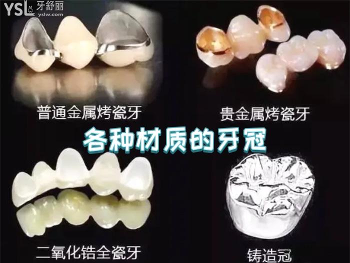 南京医院可以做全瓷牙冠的有哪些？在南京烤瓷牙套一个多少钱呢？