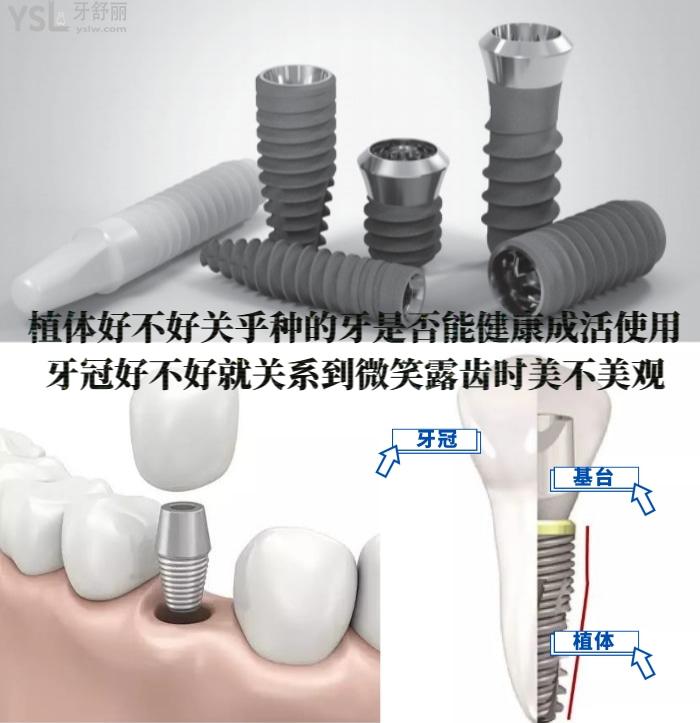 老人安装全口假牙多少钱？北京朝阳区种植牙哪个医院便宜又好？