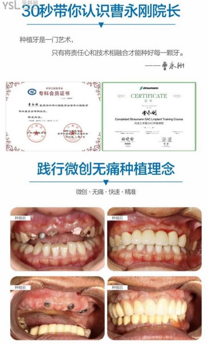 郑州种植牙比较好的口腔医院