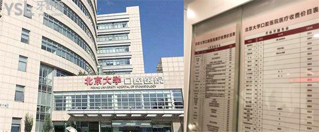 北京口腔医院价格表 北京正畸种植牙多少钱