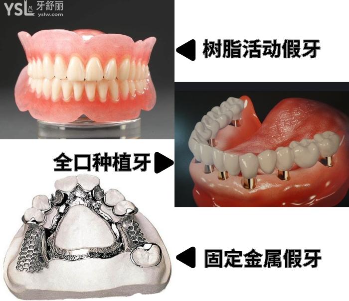 老人做全口假牙托是树脂的好还是金属好？做一口假牙多少钱？