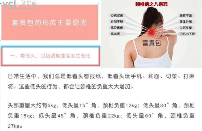 夺命富贵包你还留着快来惠州诗璐医疗美容门诊部富贵包一针消除