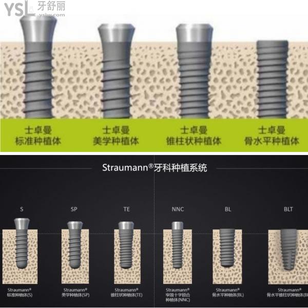 种植牙携带体图图片