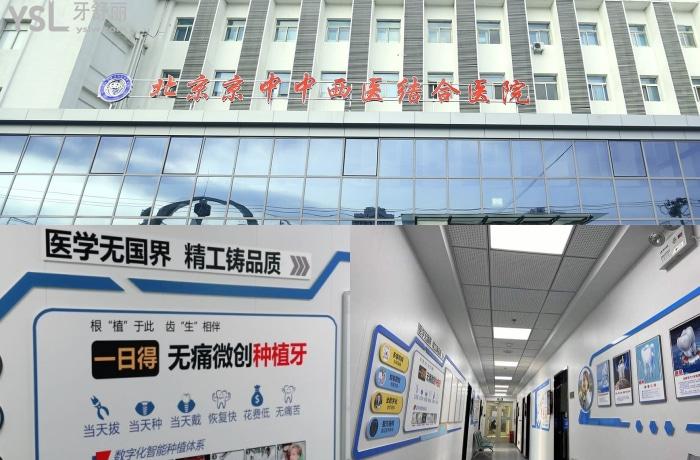 北京京中中西医结合医院怎么样？看牙可以走医疗保险的正规口腔医院，技术强口碑好！