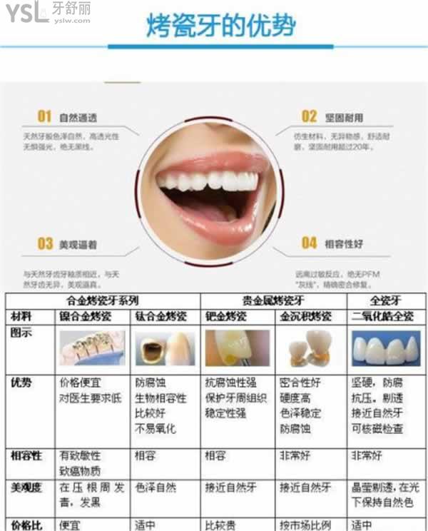 北京各口腔医院镶牙价格表，做烤/全瓷牙冠多少钱一颗