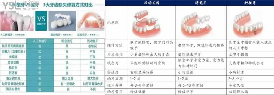 福州做全口假牙多少钱