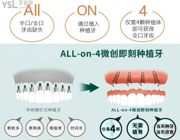 广州种植牙哪个医院做的好?这些有名的种植牙医生价格公道口碑好不可错过!