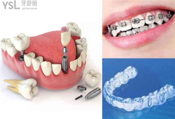 杭州口腔医院种植牙矫正多少钱