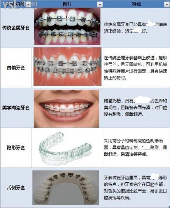 广州增城做牙齿矫正大概费用是多少