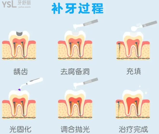 广州哪里治疗牙痛好?看牙齿有哪些医院推荐?看牙又好又便宜就来这几家!