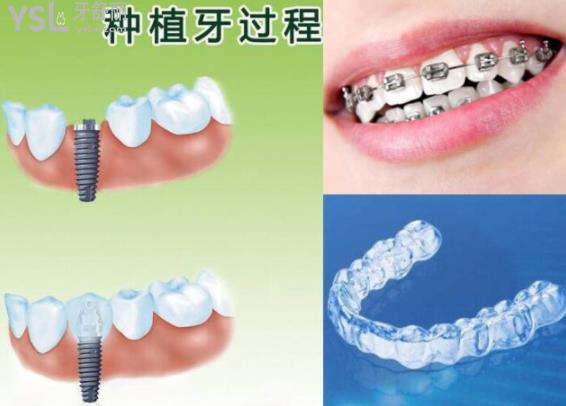 南京种植牙矫正医院排名榜