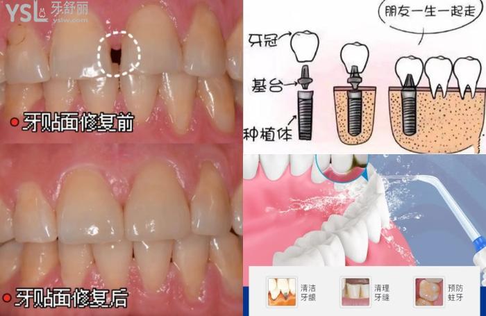广州看牙齿有哪些医院推荐？看看广州十大牙科医院排名！看的好又便宜！