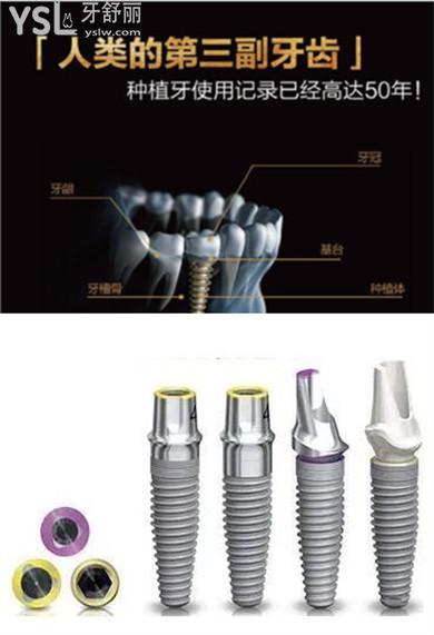 成都口碑较好的种植牙医院 成都种植牙排行前十