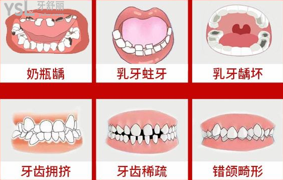 请把这条大数据推给缺牙的人，福州维乐口腔医院帮助缺牙人士重拾口福！