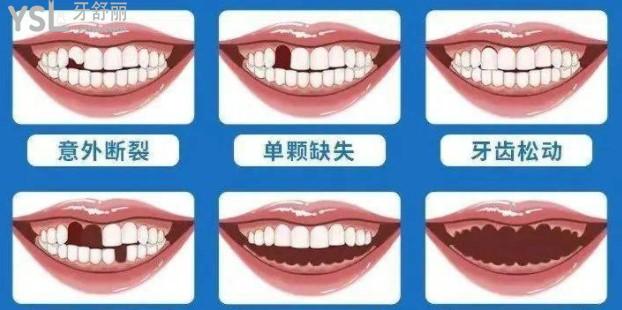 东莞口腔医院**活动