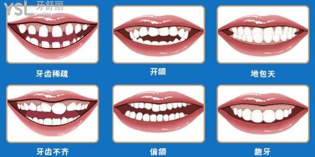 东莞口腔医院**活动