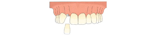 麦芽口腔收费价目标准