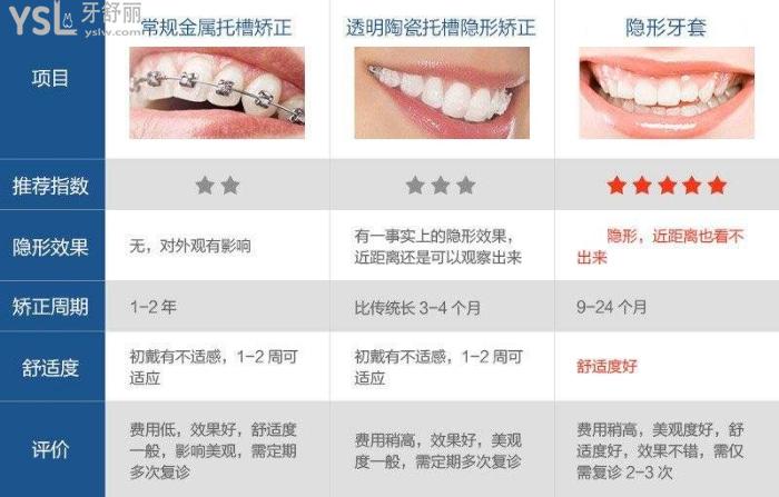各种牙齿矫正的优势
