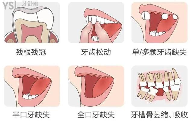 郑州唯美口腔医院看牙补贴
