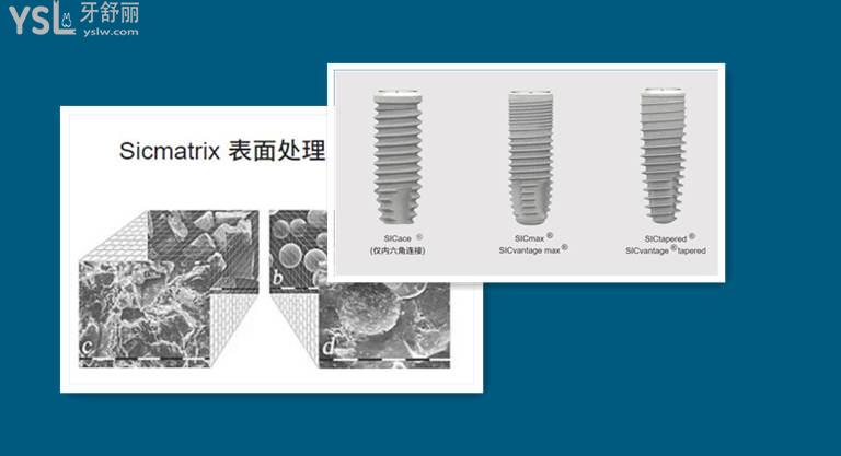 韩国登腾和奥齿泰种植牙品牌区别