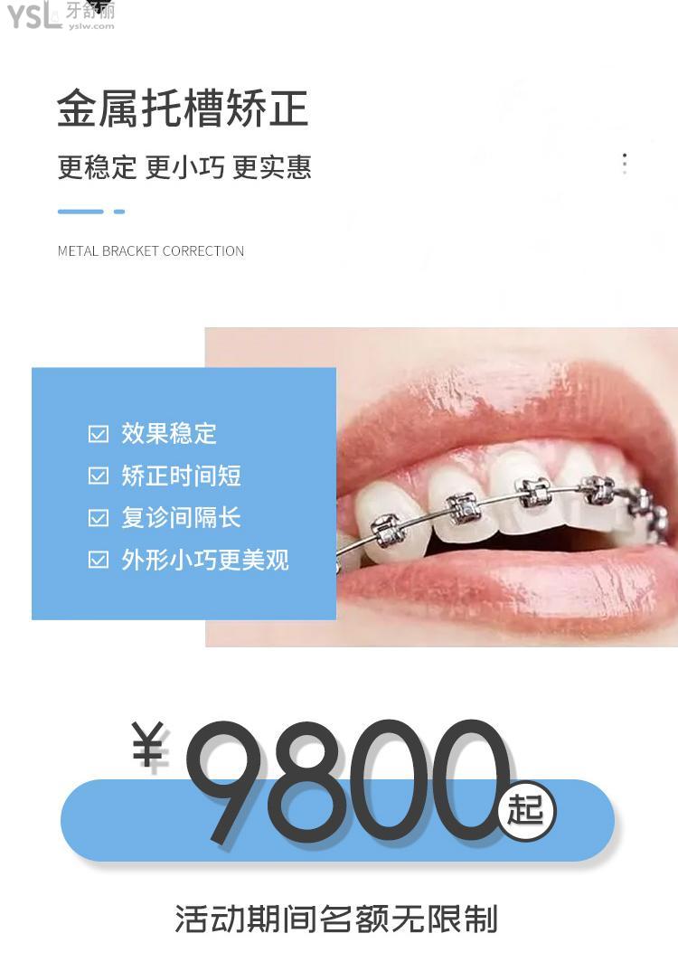 真香！上海鼎植口腔医院隐适美你猜多少钱？